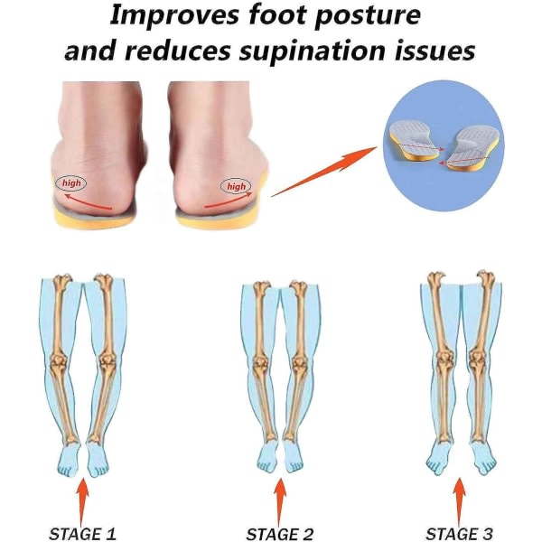 Supinasjonssåler for overpronasjon og høy buestøtte, ortopediske innleggssåler for fotjustering, knesmerter, bøyde ben