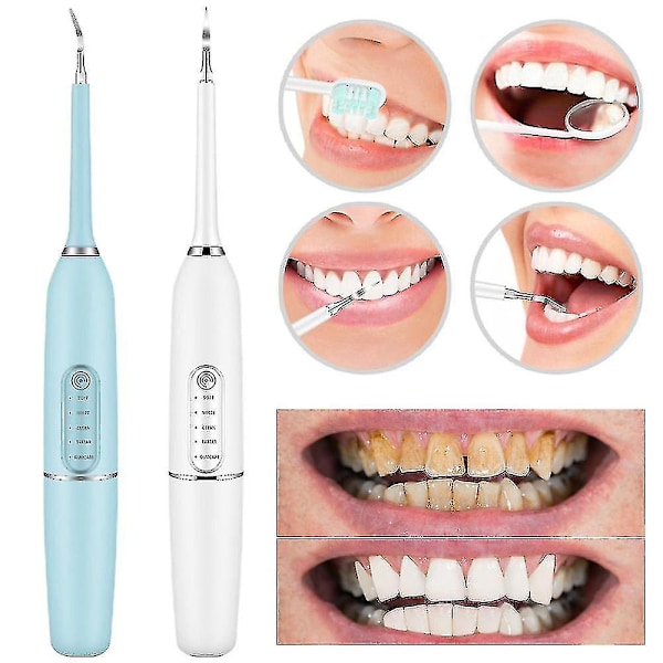 Sähköinen Hammaspuhdistussarja Hammaskiven Poistaja Tahranpoistaja Hammaspuhdistussarja 5 Tilaa Latautuva White Toothbrush