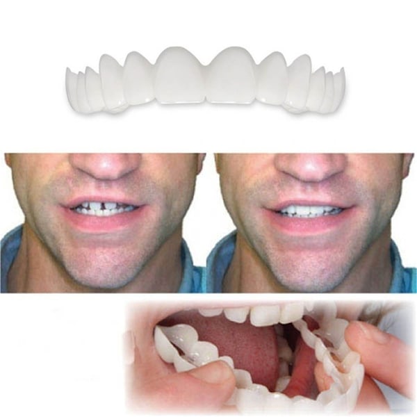 Falske tænder, protesetænder, midlertidige snap-on-finér, der dækker de ufuldkomne tænder, fikser et selvsikkert smil, midlertidige falske tænder