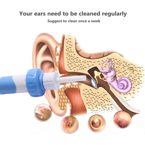 1 ST Elektrisk öronvaxborttagningssats, elektrisk dammsugare för öron, ta bort