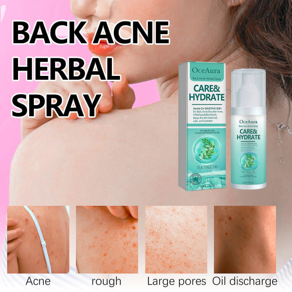 Rygg Acne Treatment Spray, Back Acne Herbal Spray Acne Control Cleanser Reparera aknefläckar och finnar för tonåringar Rygg Acne Solution -120ml 2pcs - 240ml