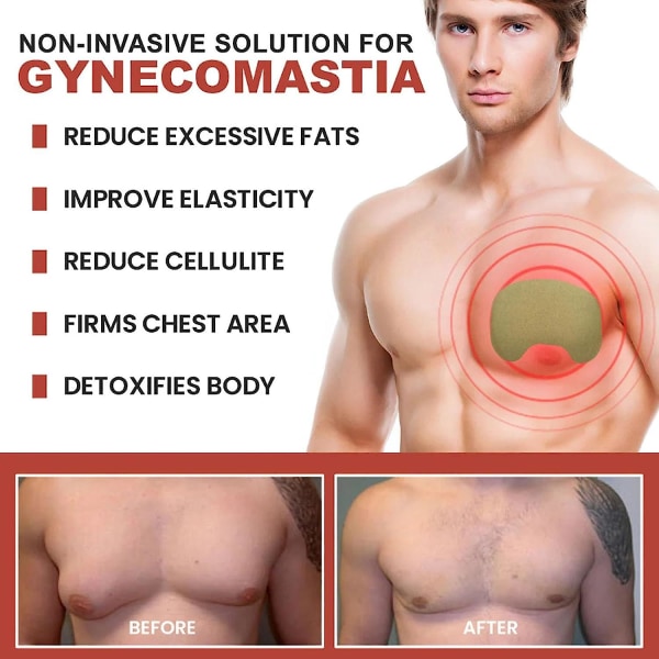 Gynecomastia Cellulite Melting Patch, Gynecomastia Cellulite Melting Patch,gynecomastia Tightening Ginger Patch,chest Belly Fat Remove For Men 2 boxes 24 Pcs