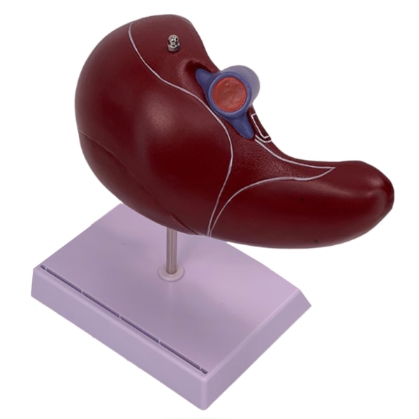 Anatomisk Levermodell Visar Detaljer Om Leverns Blodkärlsystem ...