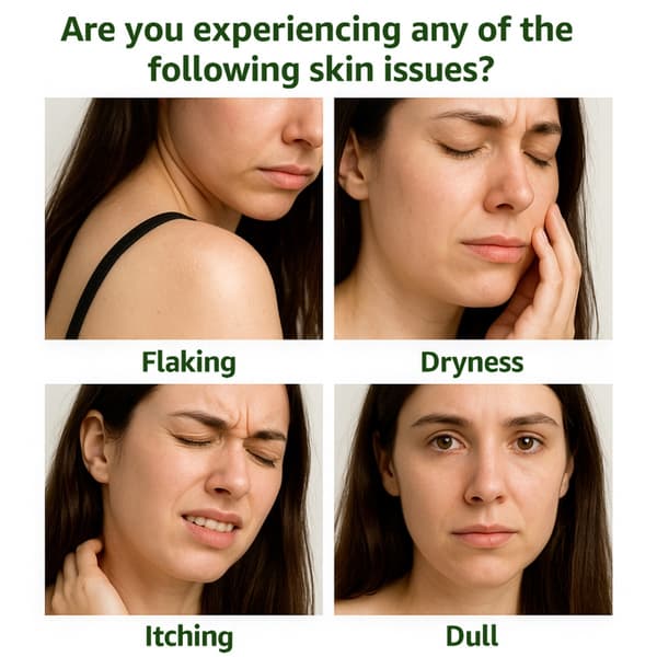 Naturlig Växttvål Exfolierar Skonsamt Och Lugnar Problemhud