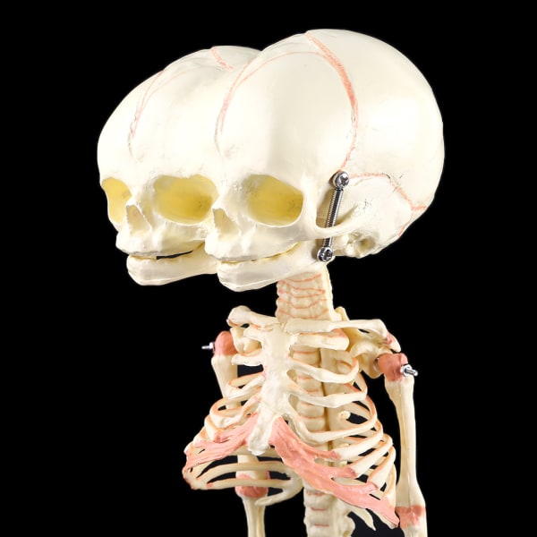 Baby deformerad för huvud Skalle Forskningsmodell Skelett Anatomisk hjärna Anatomi Undervisning Study Display