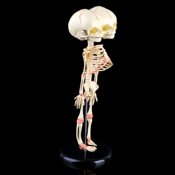 Baby deformerad för huvud Skalle Forskningsmodell Skelett Anatomisk hjärna Anatomi Undervisning Study Display