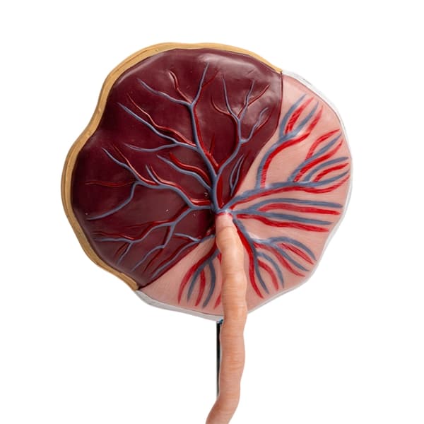 Placenta Anatomi Model Med Navlestreng Dele Til Klinisk Demonstration