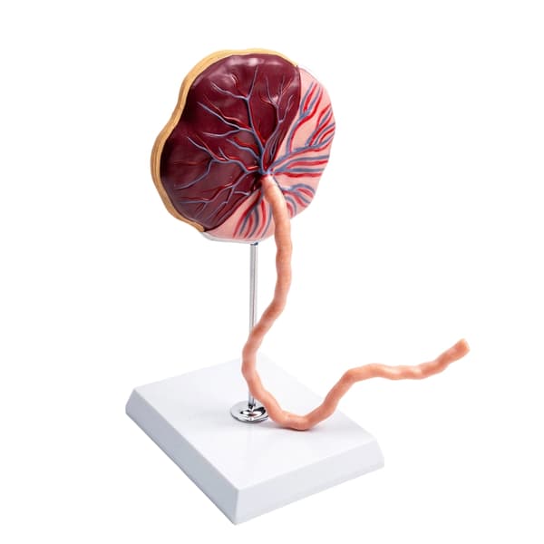 Placenta Anatomi Model Med Navlestreng Dele Til Klinisk Demonstration