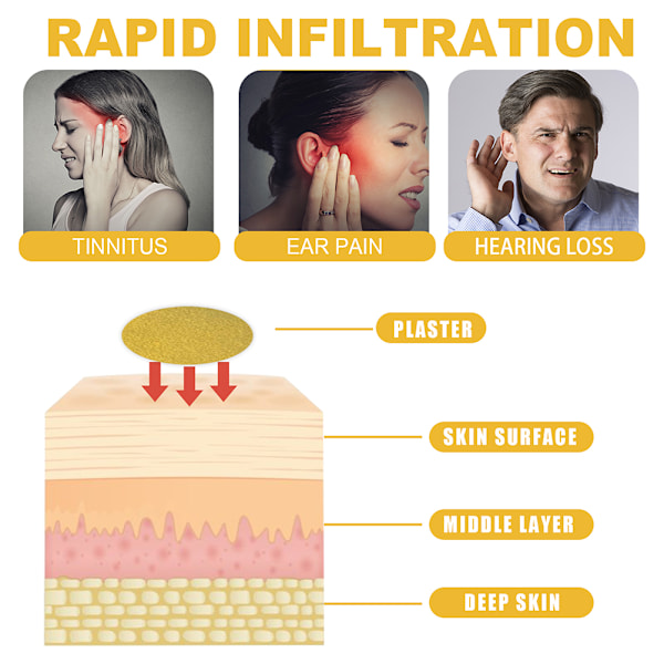 Öronplåster mot tinnitus med ingefära - Naturlig växtbaserad hälsovård