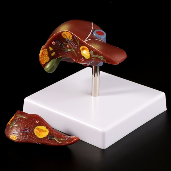 Medicinska rekvisita modell Mänsklig Lever Patologisk Anatomisk Modell Anatomi Skola Medicinsk Undervisning Display Verktyg Labbutrustning
