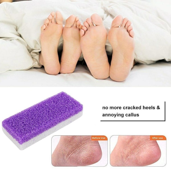 Fot Pimpsten Svamp Förhårdnader Exfoliera Sten Hård Hud Pedikyr Rem