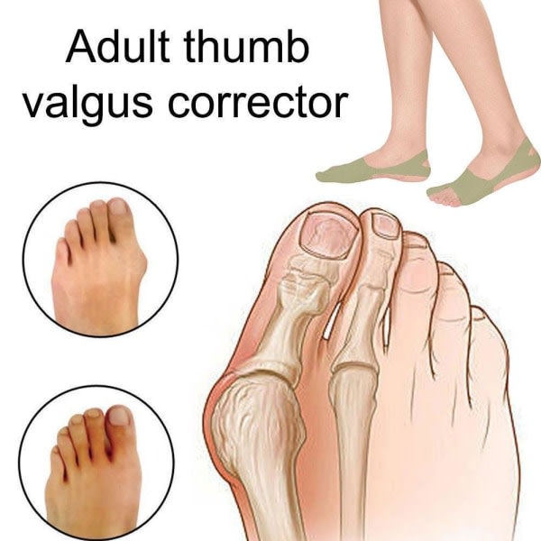 Knivtåavskiljare Gel Pad Sleeves Correctors Hallux New Valg AL One-size