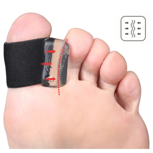 Bunion Spacer Tå Separator Skydd Knyst Corrector Sträcker ut stortån rätar ut överlappande tår,4pack