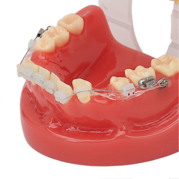 Ceramic Dental Orthodontic Demonstration Model 24 Teeth Model with Wires and Bracket for Teaching Education