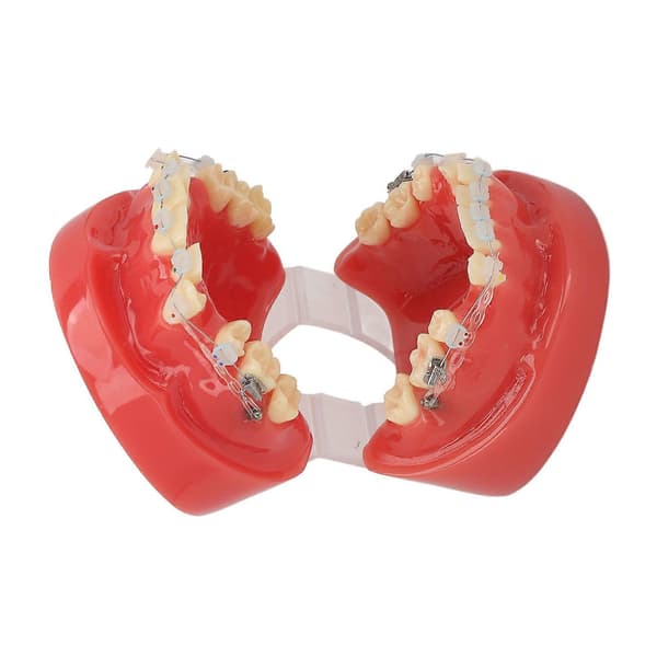 Ceramic Dental Orthodontic Demonstration Model 24 Teeth Model with Wires and Bracket for Teaching Education