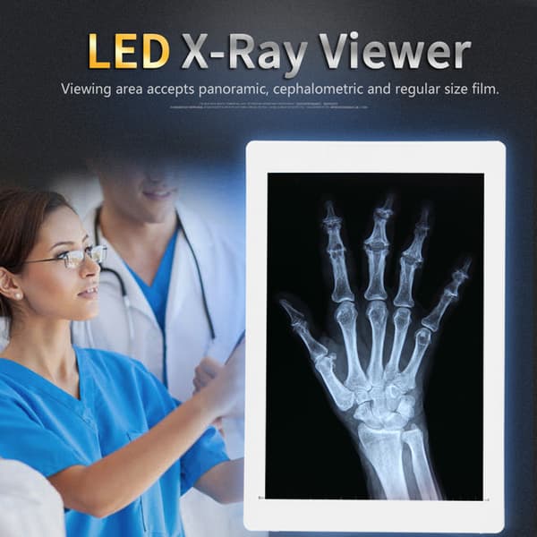 EU-plugg AC 100-240V LED røntgenviser med høy lysstyrke 36x24cm