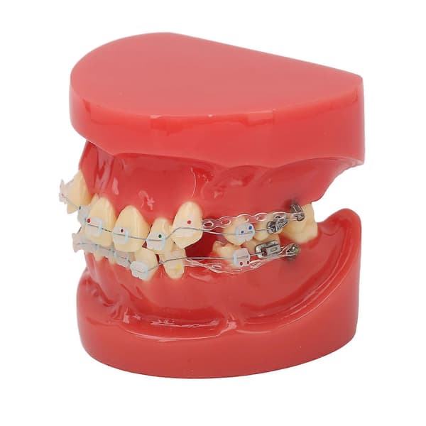Ceramic Dental Orthodontic Demonstration Model 24 Teeth Model with Wires and Bracket for Teaching Education