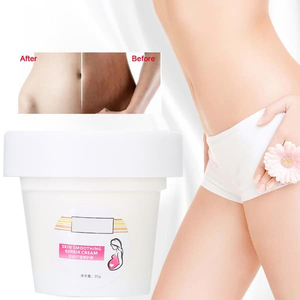 Fjernelse af strækmærker creme - Beroligende behandling for graviditetsar, 35g