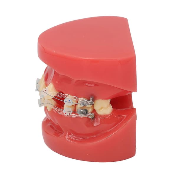 Ceramic Dental Orthodontic Demonstration Model 24 Teeth Model with Wires and Bracket for Teaching Education