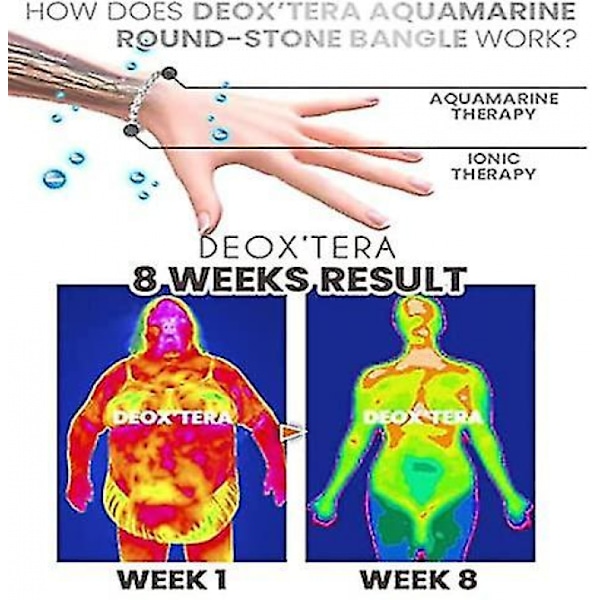 Lymfdränage Terapeutiskt Magnetiskt Armband för Kvinnor Artrit