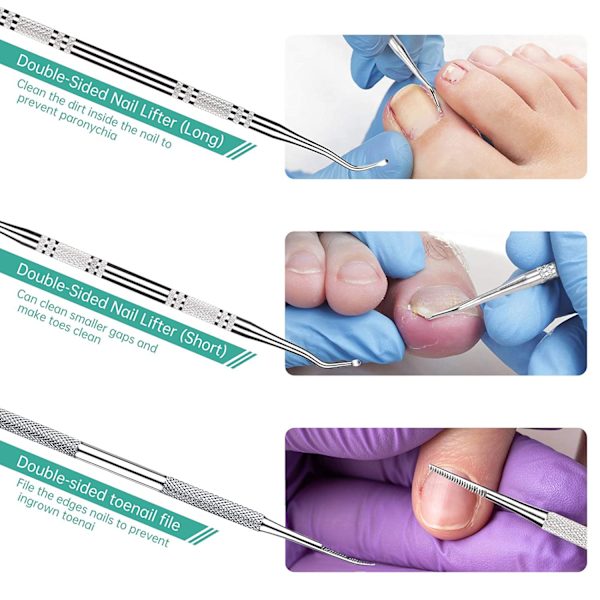 3-pack inåtväxta tånagelfil och lyftare, professionell kirurgisk fläck