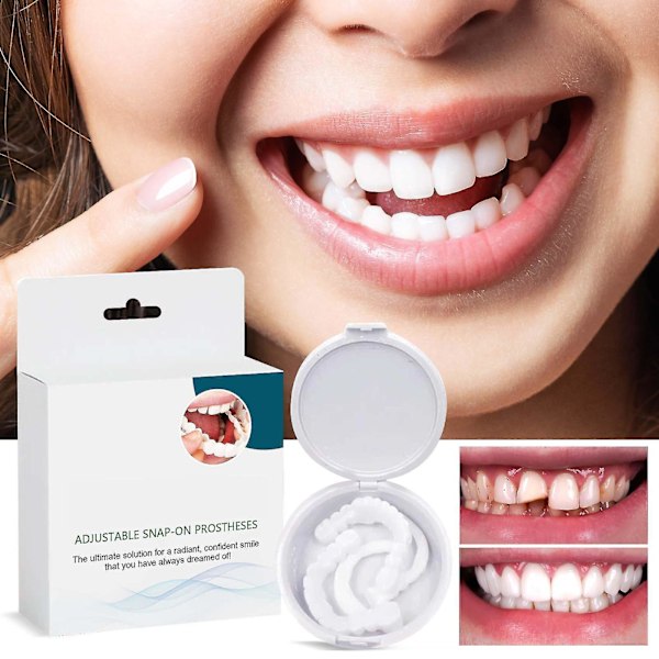 Midlertidige proteser Falske tenner for Snap On Instant & Confidence Smile, Dental Veneers For Temporary Tooth Restoration