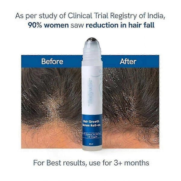 1-3X Hårvækstserum Roll On - 3% rosmarin, 3% Redensyl & 2% - (25ml) 2stk 2pcs