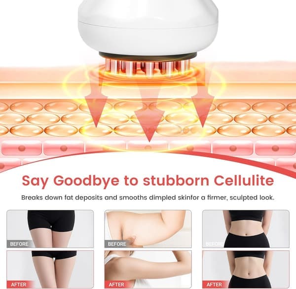 Lymfedrænage massager – Dyb massage til krop & cellulite hvid