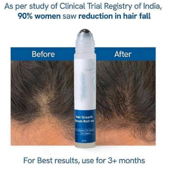 1-3ST Hårvækstserum Roll On - 3% rosmarin, 3% Redensyl & 2% 2stk 2pcs