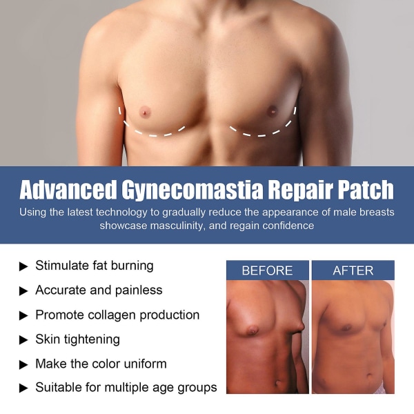 Gynopatch Gynecomastia Compress Patch, Gynopatch Gynecomastia Patch, Gynecomastia Cellulite Melting Patch, Anti Cellulite Patch 2 pcs
