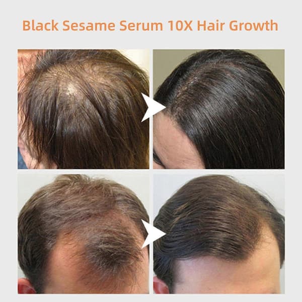 Sort sesam - sort ris & rosmarin vand hårspray serum hårtab behandlinger 30ml