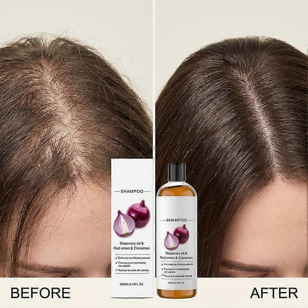 Hilseenesto Rosmariini Sipuli Shampoo - 200ml