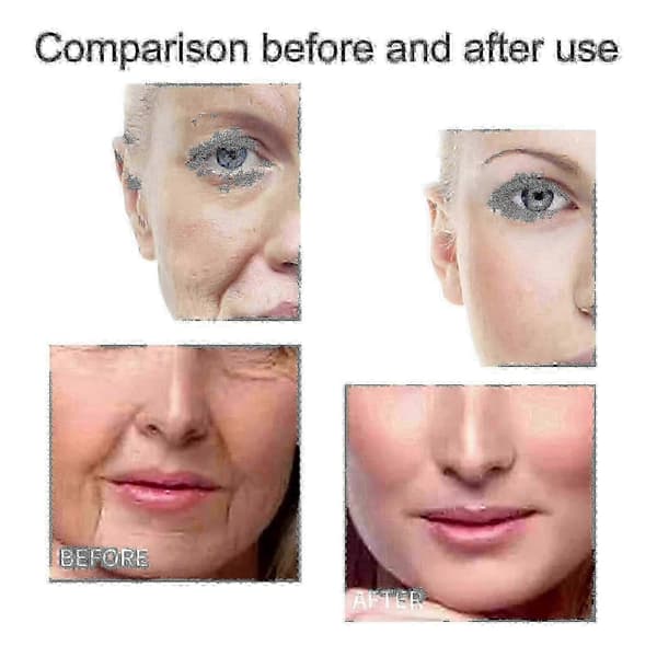Eelhoe Kollagenforstærket Anti-aging Serum