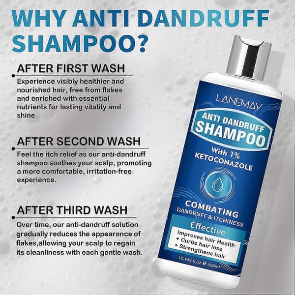 Anti-skælshampoo med 1% Ketoconazol, frisk duft, 300ml