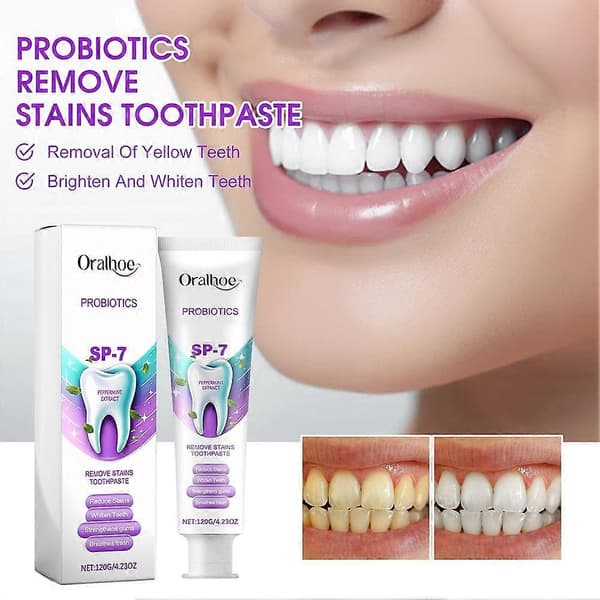 SP-7 Probiotika Whitening Ta bort fläckar Tandkräm