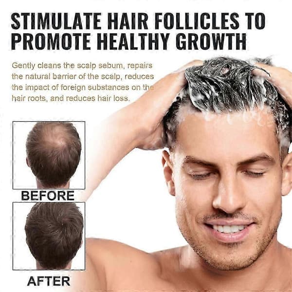 1-3 stk. Root Activator Shampoo, SPARTAN Hårtabsshampoo, Shampoo Root Activator 1pc