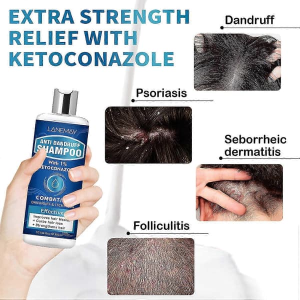 Mjällschampo med 1% Ketokonazol, Fräsch Doft, 300ml