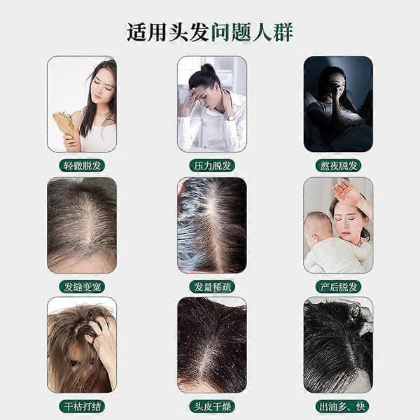 Zhangguang 101 Shampoo til Reduktion af Hårtab og Øget Tæthed 1pcs