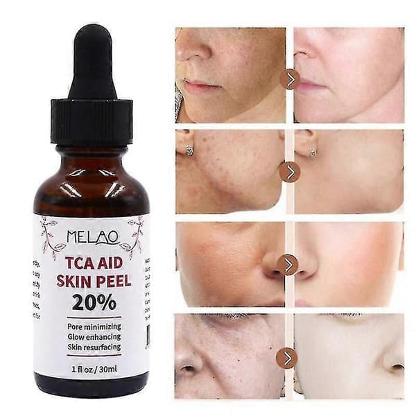 30 ml triklorättiksyra 20 % hudpeeling ansiktsvårdsserum