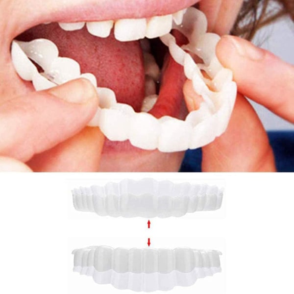 1 par Snap On Teeth Finér til mænd og kvinder dækker de ufuldkomne tænder falske tand Øjeblikkeligt selvtillidssmil