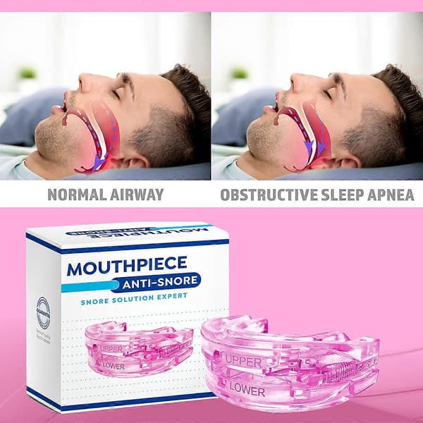 Uniapnean suusuojus Monitoiminen unihammassuoja unenlaadun parantamiseksi Pink
