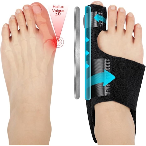 Knyst Korrektion, Stort Knyst Korrektionssæt med 2 x Ortopædiske Knystskinner og 2 x Store Tå Rettere, Justerbar Hallux Valgus Korrektion 2