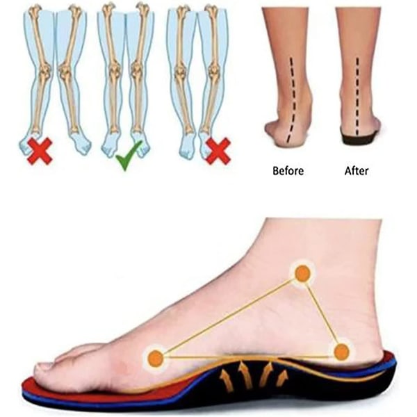 Ortopædiske sneakers til kvinder, mesh-up-stretch-platformsneakers, behagelige afslappede sneaker-gåsko (sort, 7,5) Blue EUR44