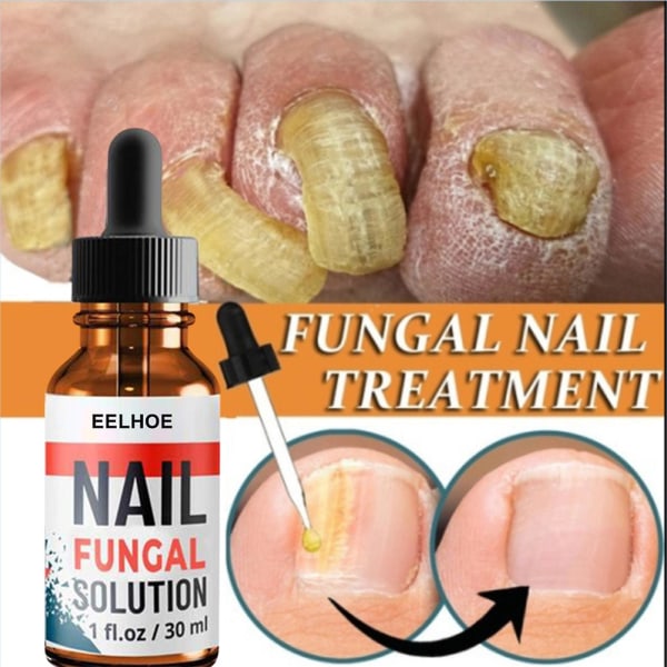 Nagelreparationslösning Hand- och fotgrå nagelvård Reparation Grå nagellösning Förtjockning och uppmjukning (3st)