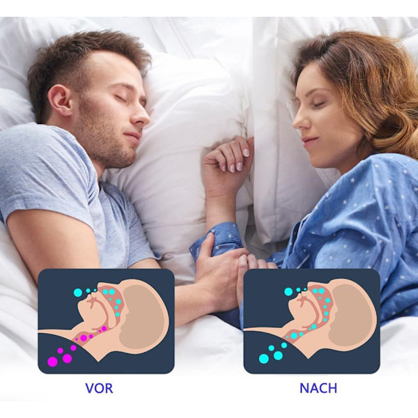Tandreguleringsbeskyttelse, snorkeskinne og snorkebeskyttelse til tænder vit