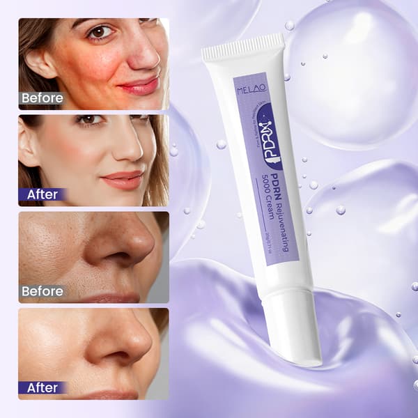 PDRN Rejuvenating 5000 Cream - Uppstramande och återfuktande ansiktskräm för elastisk, vitaliserad och reparerad hud