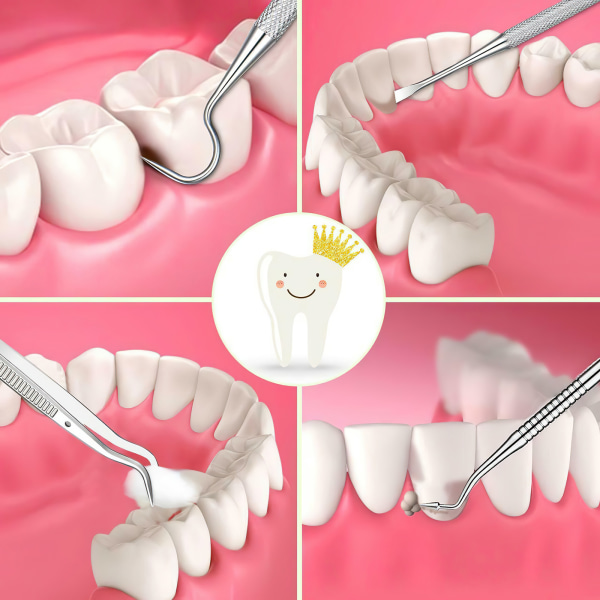 Dental Probe Set - Stainless Steel - hampaiden hampaanpoimintakaavin mi
