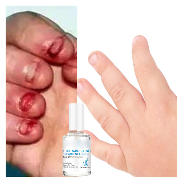 Förebyggande av Nagelbitts, Naturlig Växtbaserad Bitter Smak För Att Förebygga Nagelbitts Och Ger Näring Åt Naglarna, Lättanvänt Klart Nagellack, Säkert För Barn