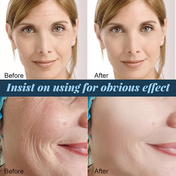 60 Protein Line Thread No Silk Fibroin Line Essence Collagen T