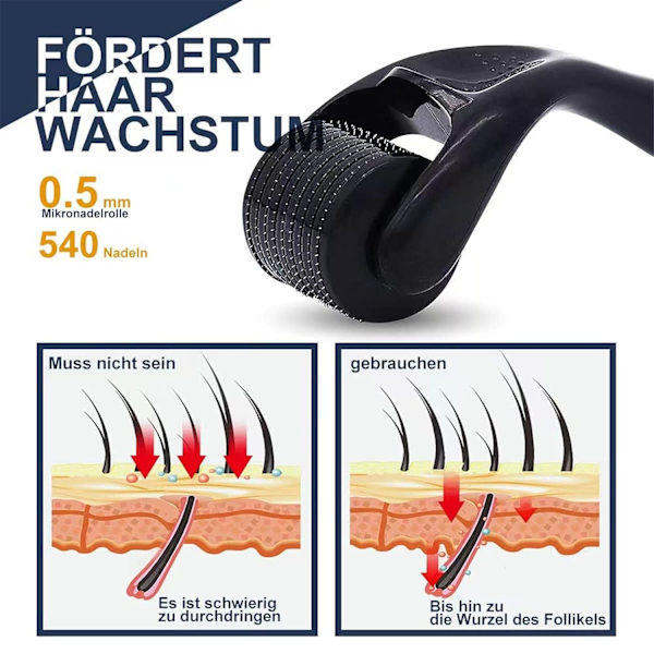 Derma Roller Rostfritt Stål Svart Mikronålsrulle 0,25 mm